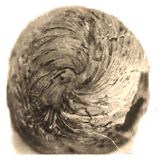 Верхушка сердца